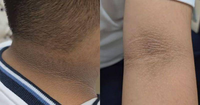 Instagram.com/iansuteja